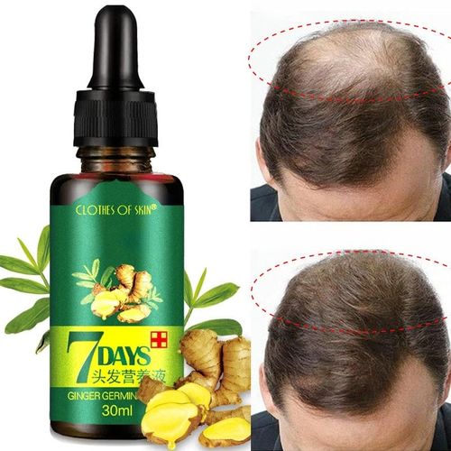 Intense Hair Growth Serum