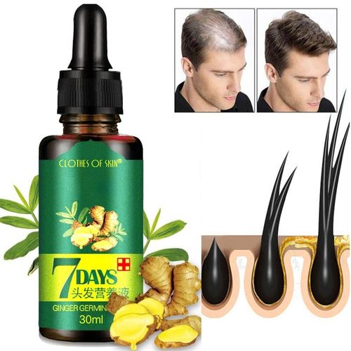 Intense Hair Growth Serum