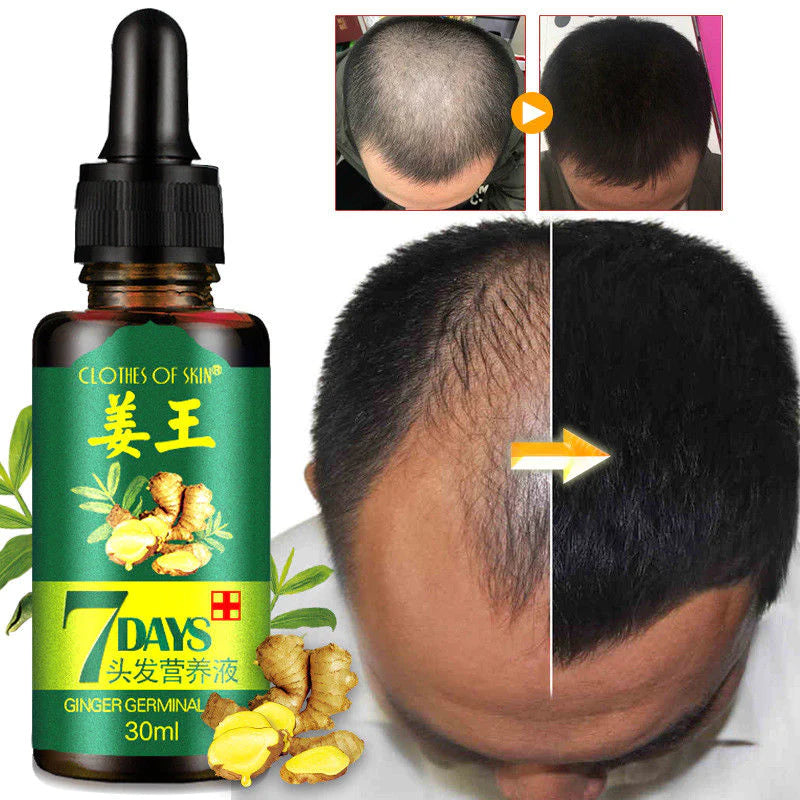 Derma Roller + Ginger Hair Growth Oil (2 in 1)