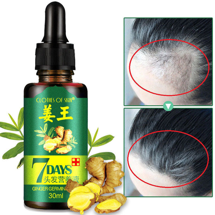 Intense Hair Growth Serum